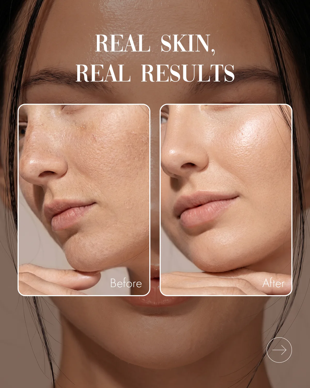 Before and after skin result
